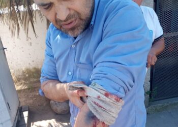 AHORA | Otro colectivero baleado en el conurbano bonaerense